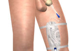 BioDerm XLS (Oval)